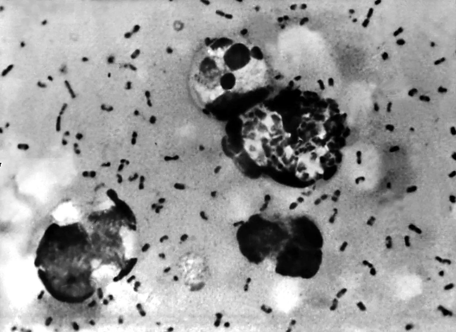 Arizona Resident Dies from Pneumonic Plague: Health Officials Warn of Rare Outbreak