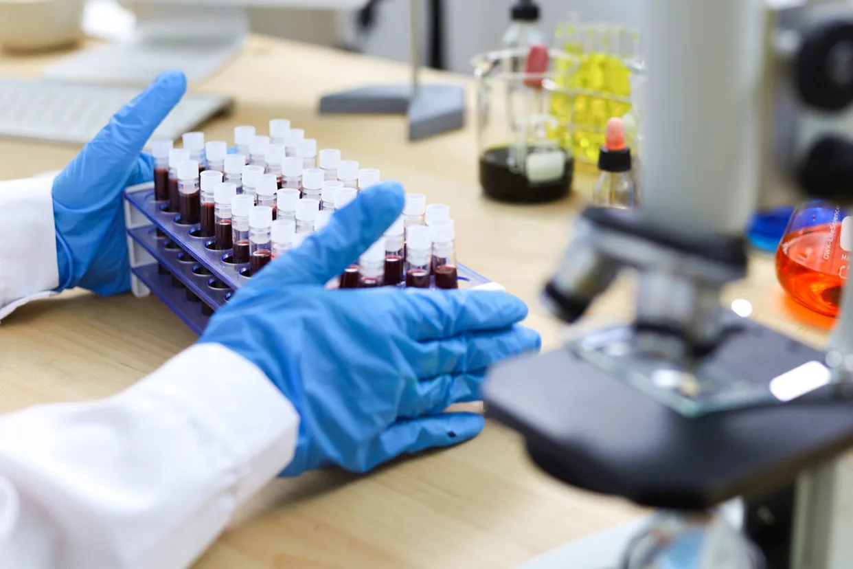 US Scientists Uncover Early Warning Sign for Deadly Pancreatic Cancer