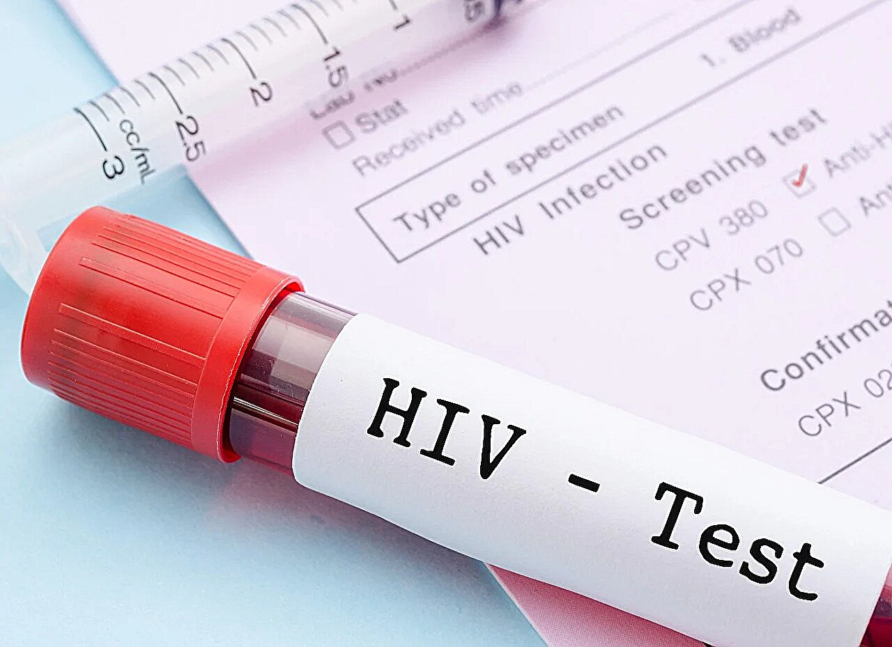 US HIV Aid Cuts Could Cause 4 Million Deaths, Warns UN